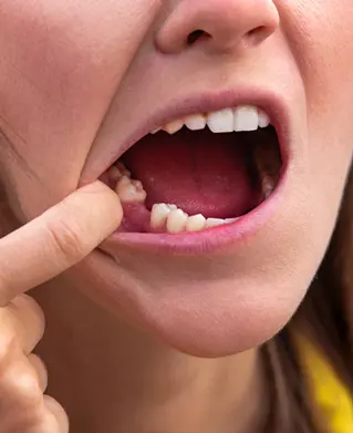 prosthodontist chandler Impressions Dental