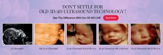 ultrasound clinics phoenix Miracle View 3D/4D Ultrasound