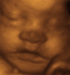 ultrasound clinics phoenix Baby's First 4D Ultrasound