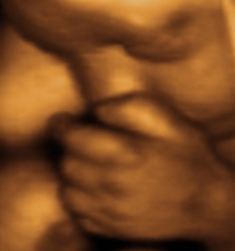 ultrasound clinics phoenix Baby's First 4D Ultrasound