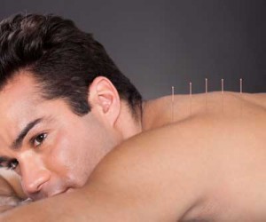 Guy Having acupuncture Session