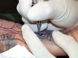 tattoo removal service scottsdale X - Tattoo
