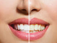 Cosmetic dentistry available at Arizona Healthy Smiles in Tempe, AZ