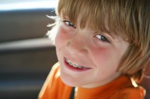 Leber Orthodontics is a Top Rated Orthodontist in Tucson and our goal is to help you Smile Big, so we make getting braces an enjoyable experience.