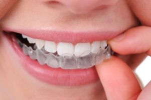 Leber Orthodontics is a 5-Star Rated Certified Invisalign Provider. We are proud to be one of the largest providers for Invisalign treatment in the Tucson area.